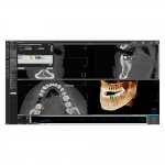 Modul 3D - Software OnDemand3D