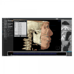 Modul 3D Ceph - Software OnDemand3D