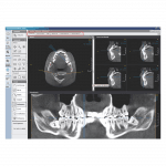 Modul Dental - Software OnDemand3D