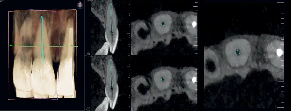 Instalatie radiologica NewTom VG-ONE 2D/3D cu brat CEPH