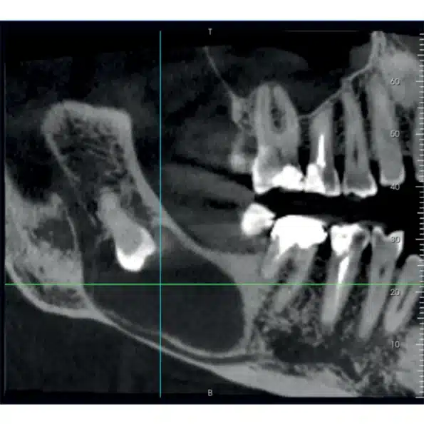 Instalatie radiologica NewTom VG-ONE 2D/3D - imagine 4