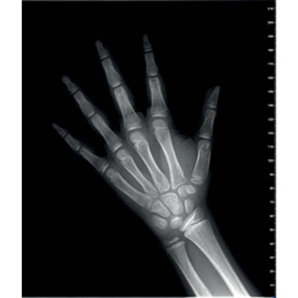 Instalatie radiologica NewTom VG-ONE 2D/3D cu brat CEPH - imagine 10