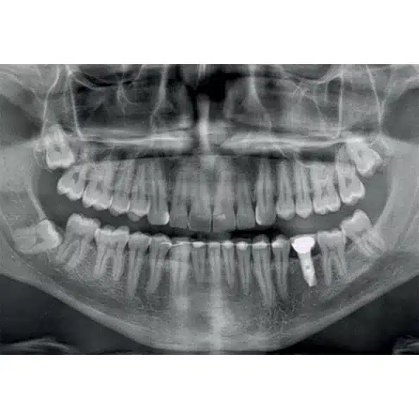 Instalatie radiologica NewTom VG-ONE 2D/3D - imagine 5