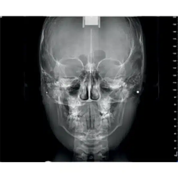 Instalatie radiologica NewTom VG-ONE 2D/3D cu brat CEPH - imagine 9