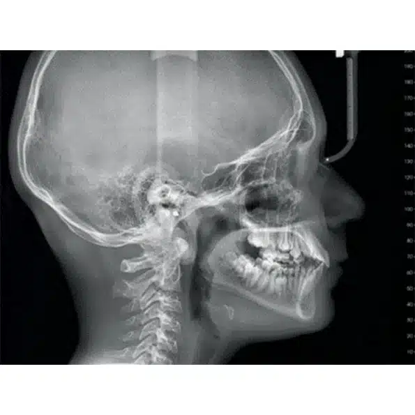 Instalatie radiologica NewTom VG-ONE 2D/3D cu brat CEPH - imagine 6